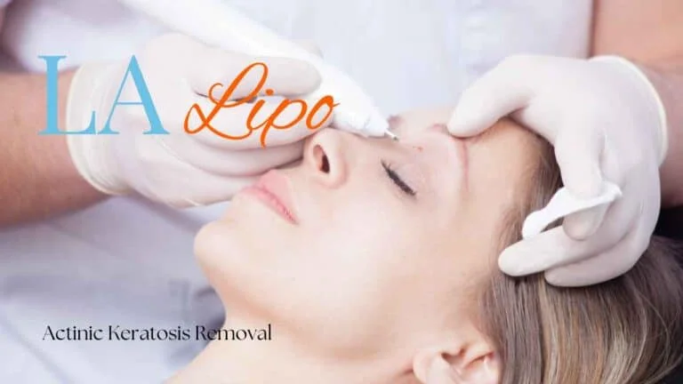 Woman receiving Actinic Keratosis Removal Treatment Dorset