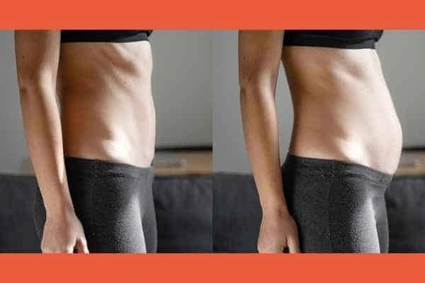 LA-EMS Body Sculpting results Dorset